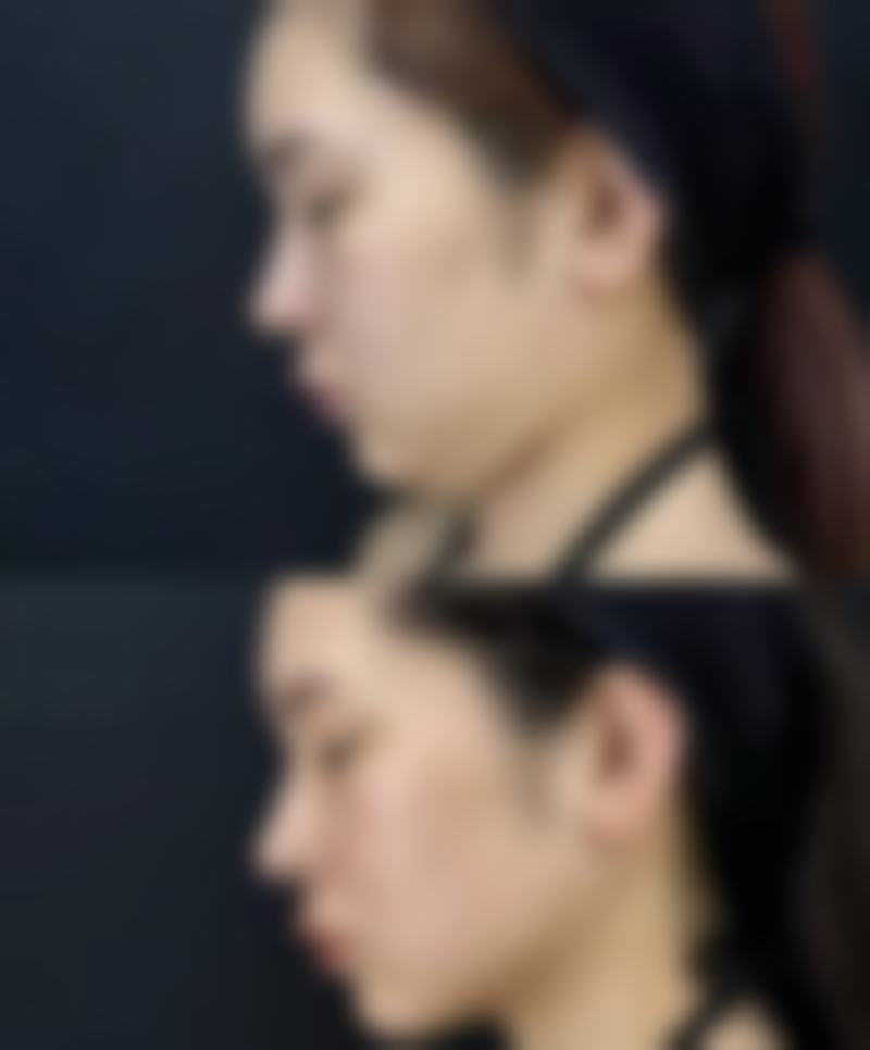 要点三:美学设计沟通妙,打造专属美眼