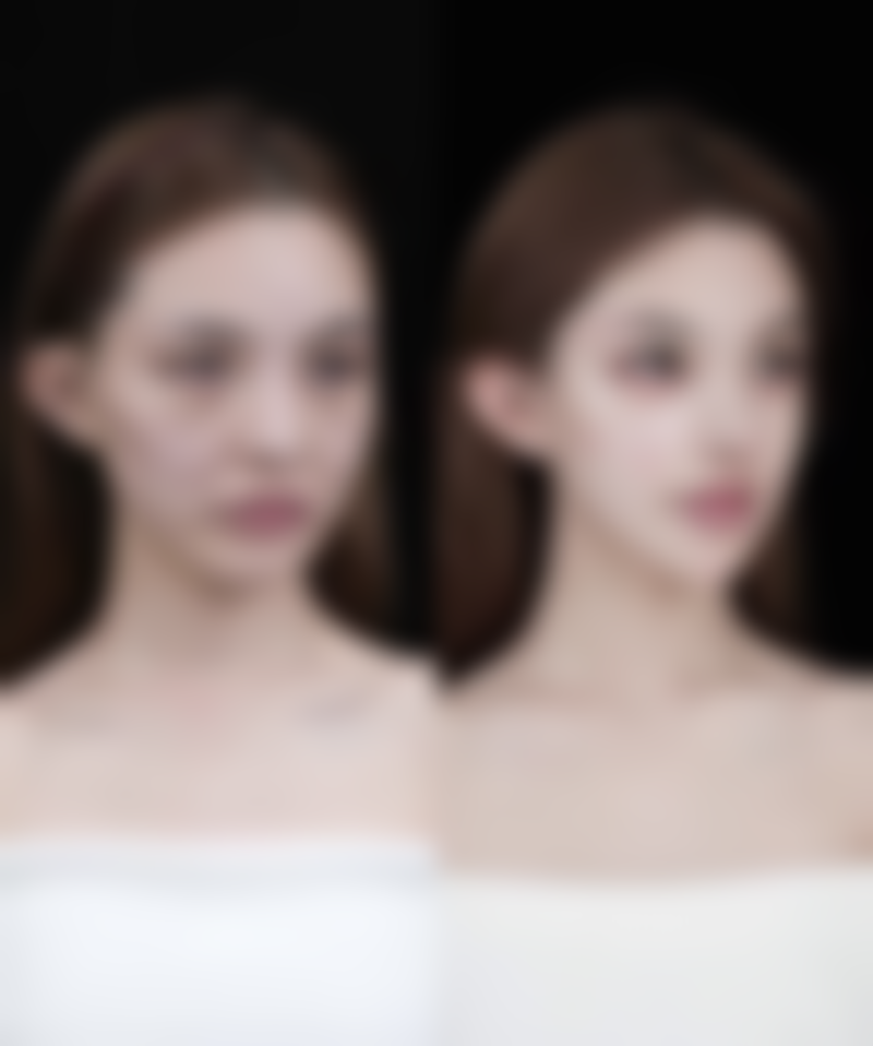 医院助力疤痕修复：疤痕膏对手术疤痕有改善作用的有力后盾