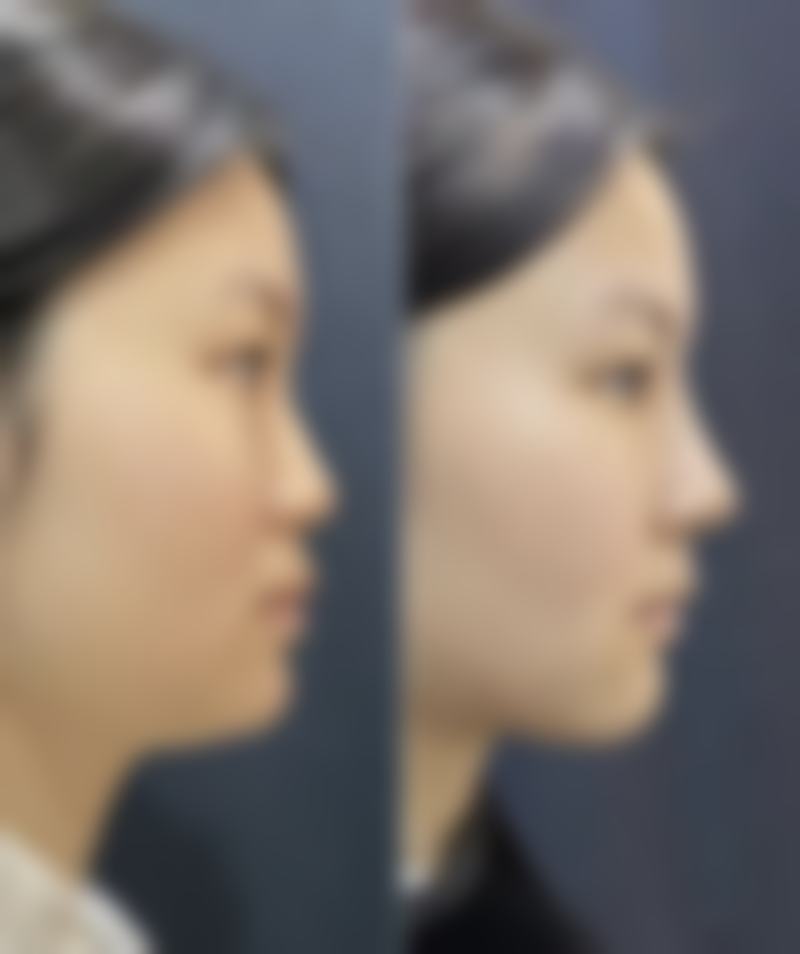 五、芜湖丹凤朝阳妇科医院医疗整形美容中 心实例