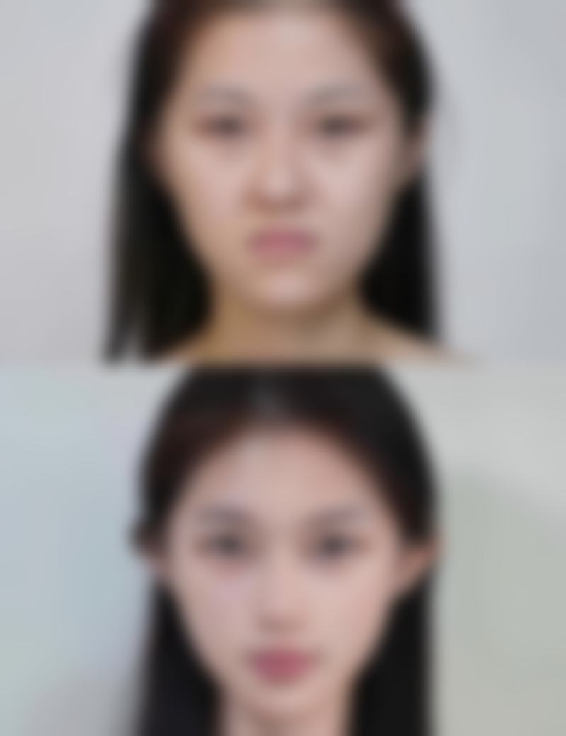 要点二:身体检查不能少,确保手术安心