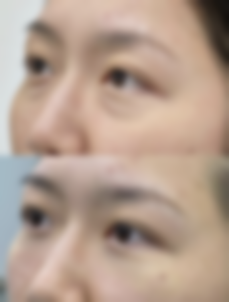 要点四:生活习惯早调整,助力手术修复