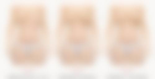 自体肋骨隆鼻成效究竟咋样?长久维持成效真不错