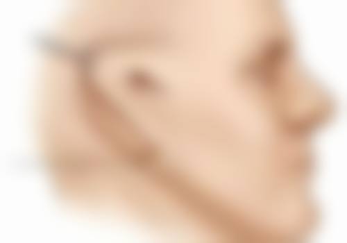 七、永善熹亚韵美整形医院价格表：（仅供参考）