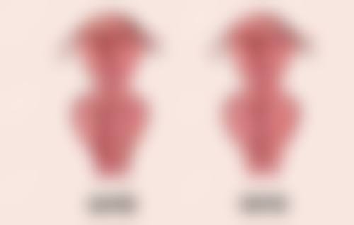 三招在手,加速凹陷脸修复