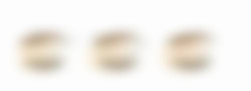 七、深圳薇阁医疗微整形医院真实的顾客评价如下: