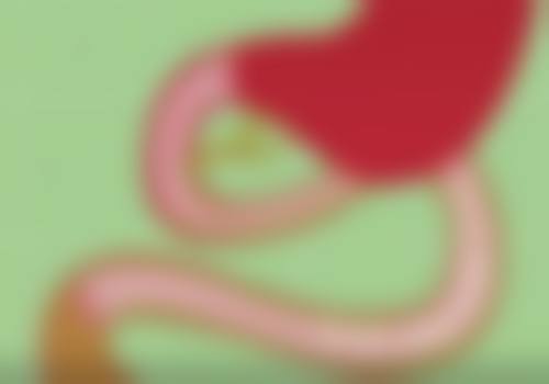 自体肋骨隆鼻成效究竟咋样?适合复杂鼻部修复