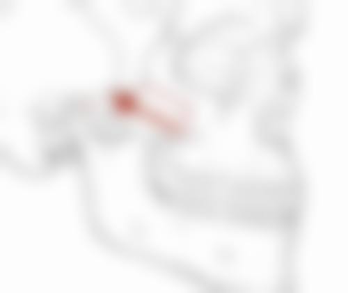 医美手段:精细打击各类眼袋