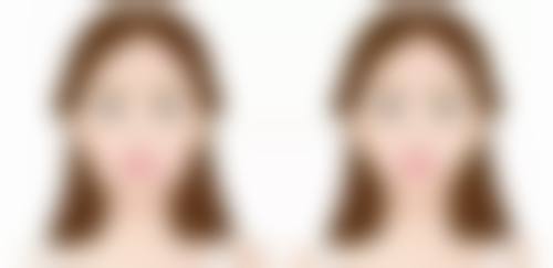 五、德阳千颂伊（一生美）医疗美容诊所怎么预约：