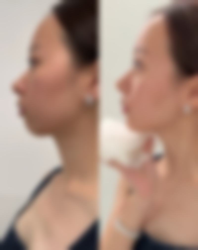 小针除皱配套医院：优质体验的重要支撑