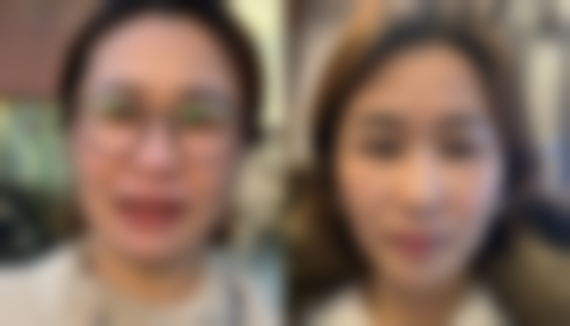 正规医院优势凸显：降低抽脂风险有保护