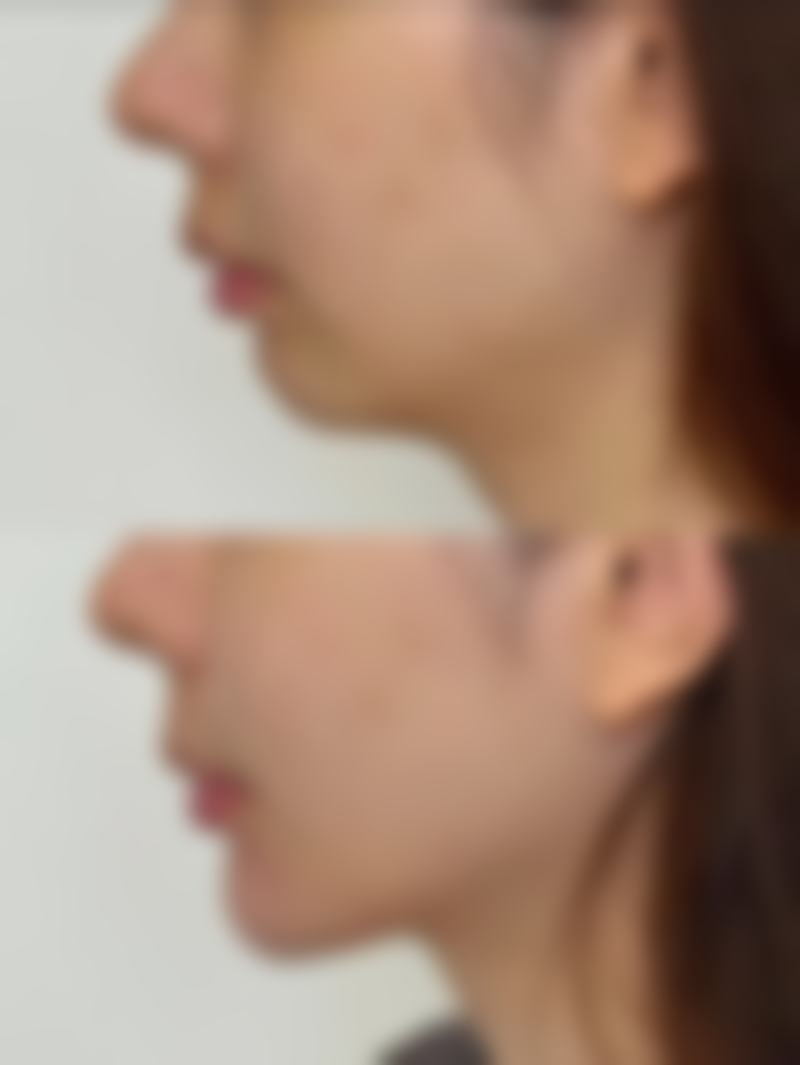 五、铁岭匠欣整形医院实例