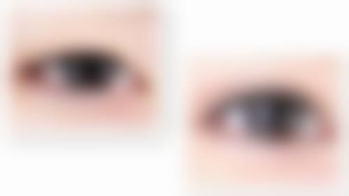 郝霞眼部整形水平怎么样可靠吗？