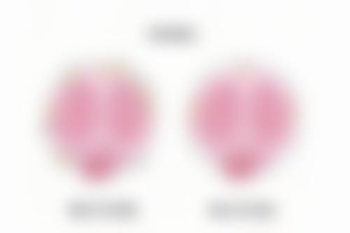 揭秘!专精医院为治疗疤痕疙瘩添助力