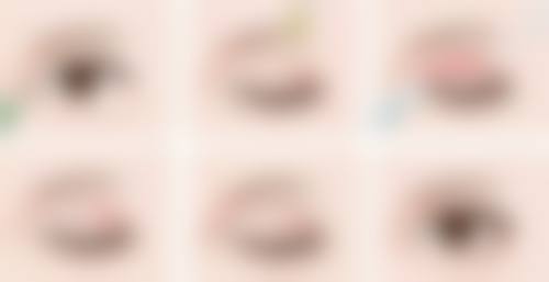 双眼皮疤痕何时淡化？揭秘3 - 12个月消退奥秘与多因素影响下的恢复指南 