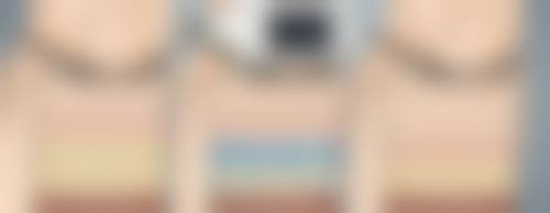 3 - 6个月后做面部吸脂,能融合啥优势