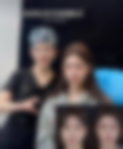 郝霞眼部整形实例