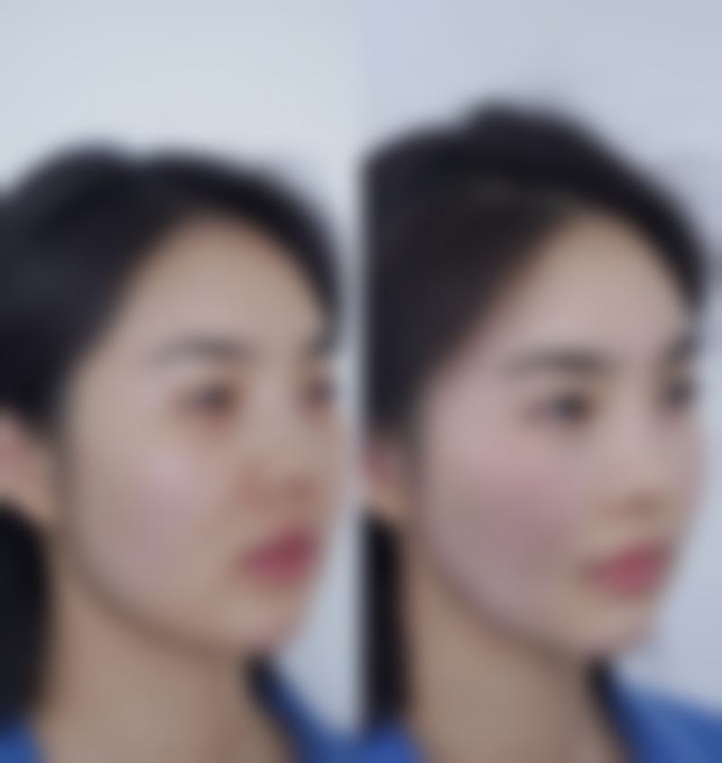 正规机构如何保护修复成效，靠谱才是王道！