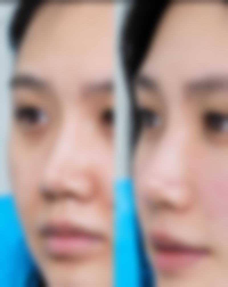 四、广州中科红后整形医院实例