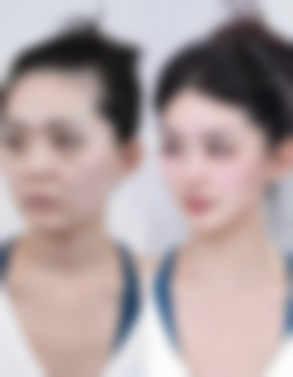 五、赣南医学校第一附属医院(整形外科)怎么预约：