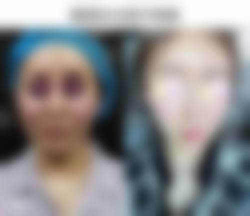 积极行动:及时与医院沟通