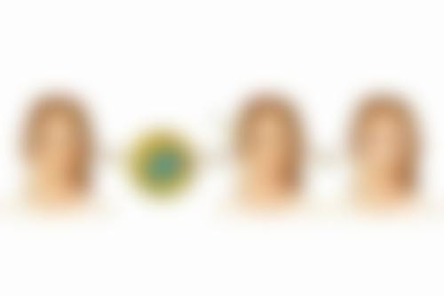 割双眼皮14天仍肿别怕！饮食与习惯调整特别重要