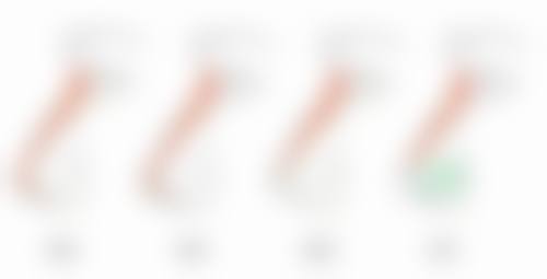 遗传、衰老、用眼过度致眼袋，医美治疗显神通