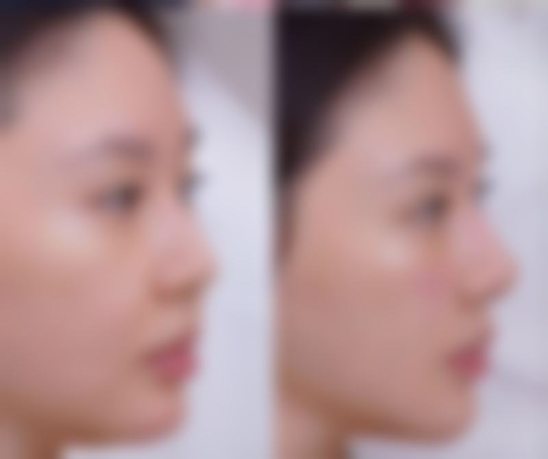 协商赔偿:争取合理权益