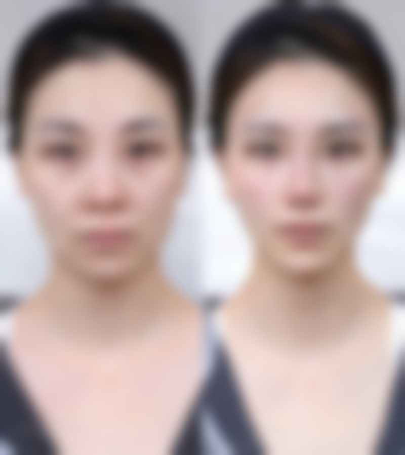 五、天津南开怡丽亚韩整形医院怎么预约：