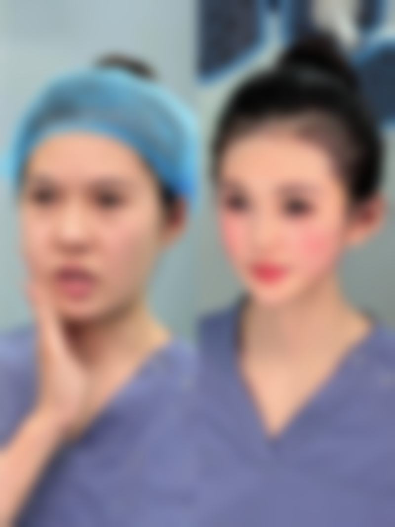 20年陈旧疤痕消除攻略大揭秘！个性化方案+专业医院助力肌肤焕然新生 