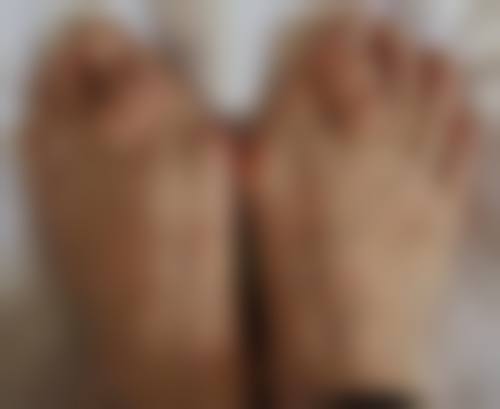 二十多年增生疤痕疙瘩能否切除？多疗法联合助切除，降低复发重塑肌肤光彩 