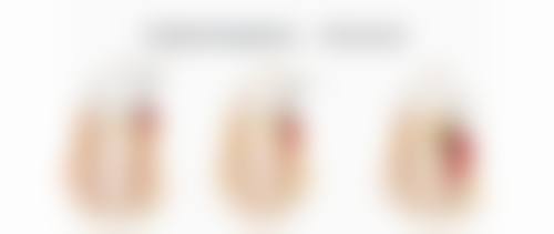 冰敷眼睛能消眼袋吗？揭秘冰敷对眼袋的改善作用及不同类型眼袋的医院解决之道 