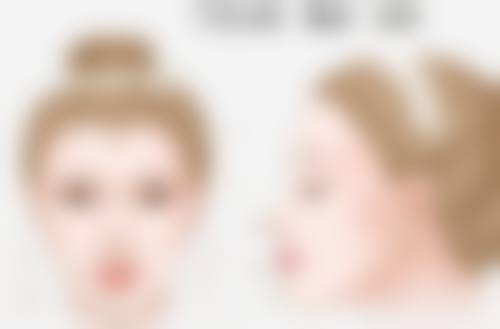 冰敷眼睛能消眼袋吗?——医院解决不同类型眼袋的方法