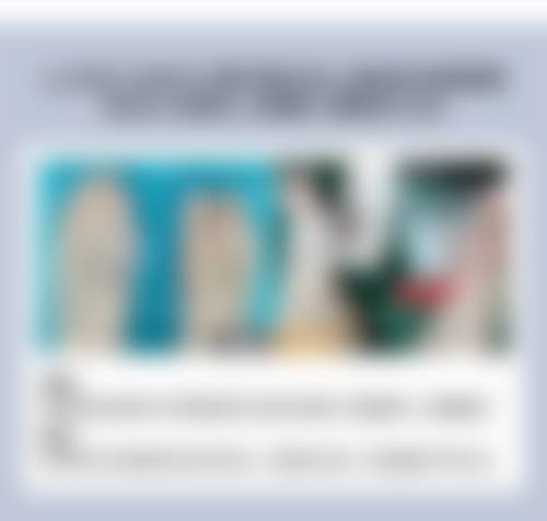 修复期间的注意事项：让你修复得又快又好