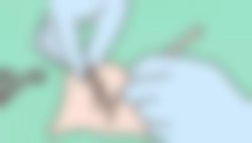 术后护理特别关键，重塑肌肤光彩有希望