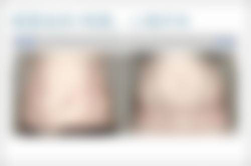 五、玉林微美医疗美容门诊部实例