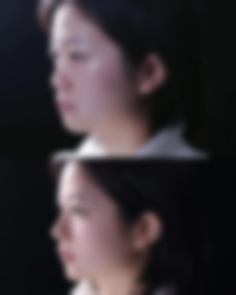 五、东莞华美医疗美容实例