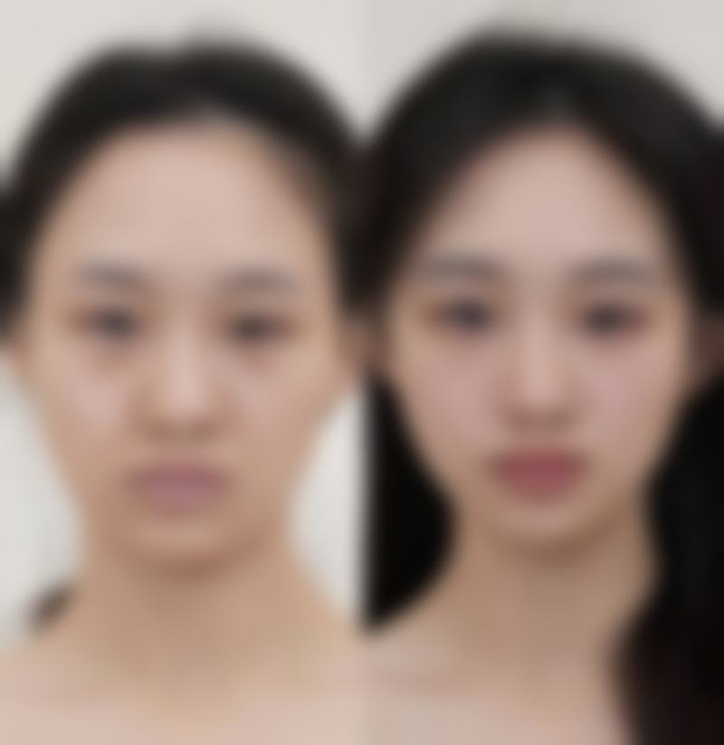 六、Bom Maru医院价格表：（仅供参考）