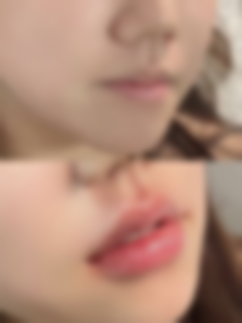 六、廊坊市乐庭医疗美容价格表：（仅供参考）