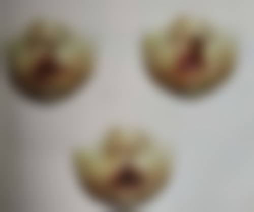 熬夜真会让眼袋变大？揭秘熬夜致眼袋成因，分享实用改善与护理妙招 