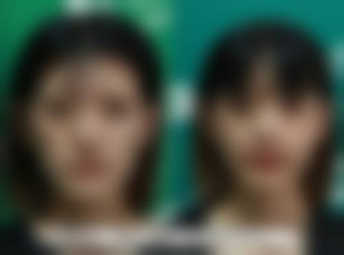 揭秘熬夜致眼袋成因:身体内部发生了啥?