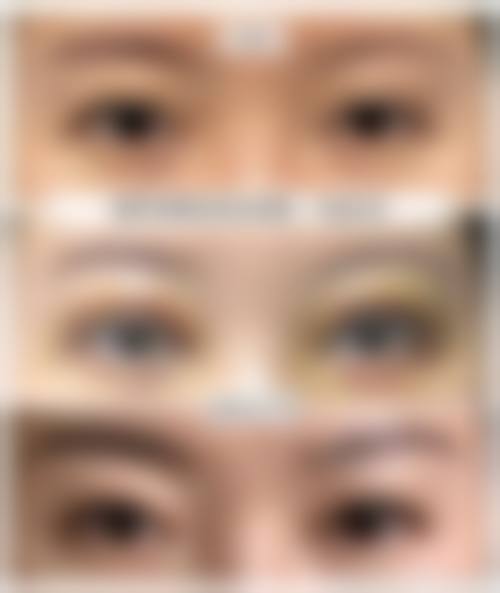 刘祥辉眼部整形项目价格表参考