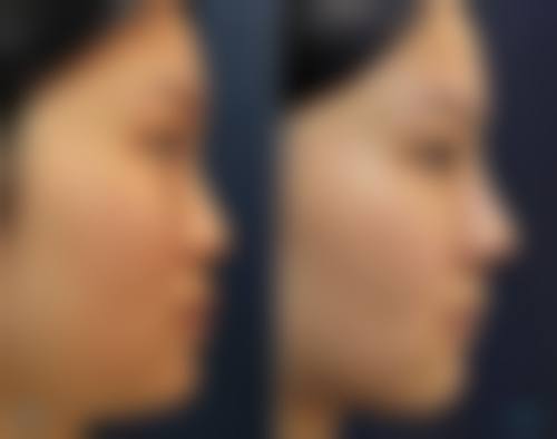 刘西富在哪家医院