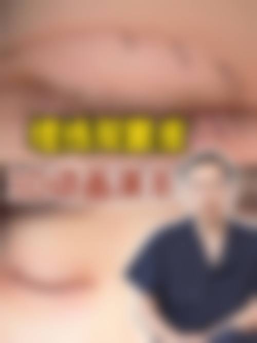 蔺娇婷怎么预约？