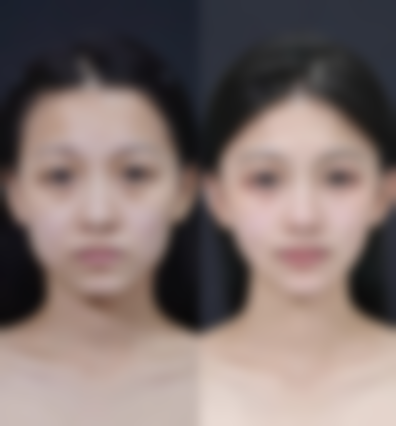 手术疤痕增生怎么治?治疗期间的注意事项要牢记