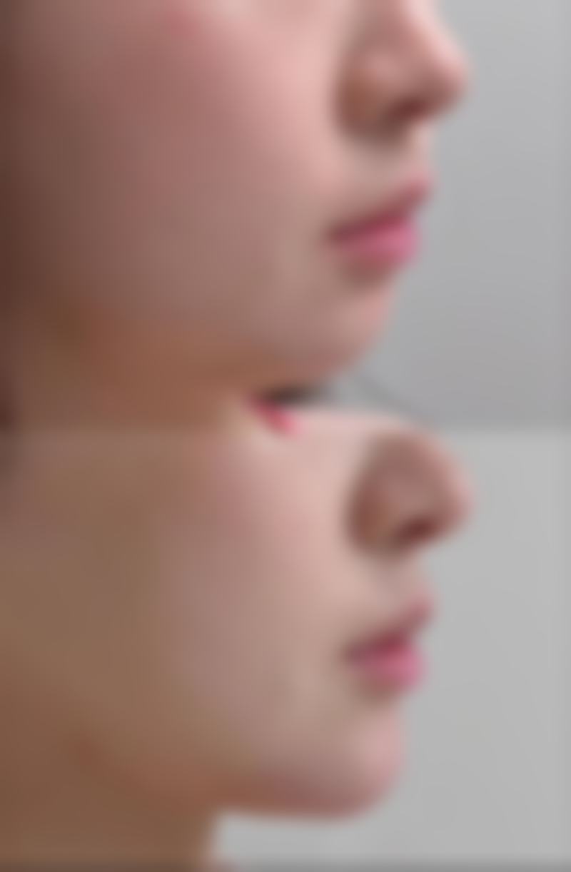 刘西富怎么预约？