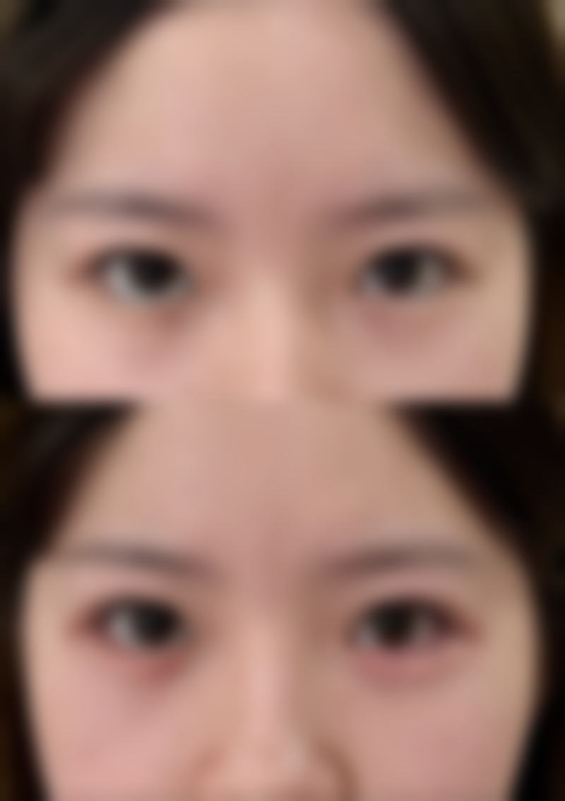 五、北京享美整形医院实例