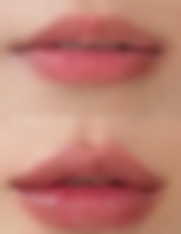 七、镇江友谊医疗美容门诊部价格表：（仅供参考）