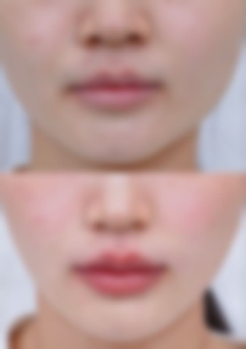 二、鞍山铁东区菲之都整形外科门诊部正规吗？来看看医院资质：