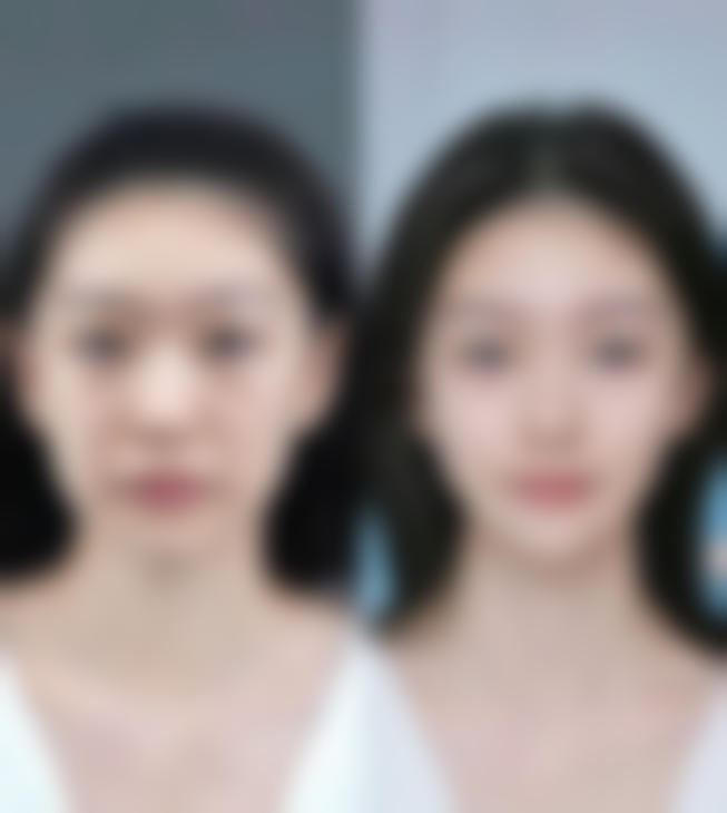 五、苏州维秘医疗美容诊所怎么预约：