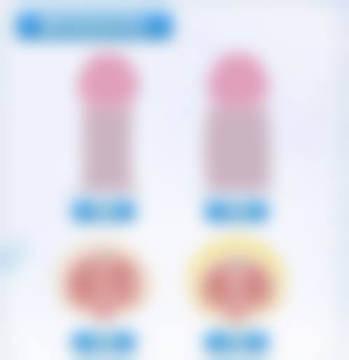 怎样把眼睛变成双眼皮?正规医院来助力